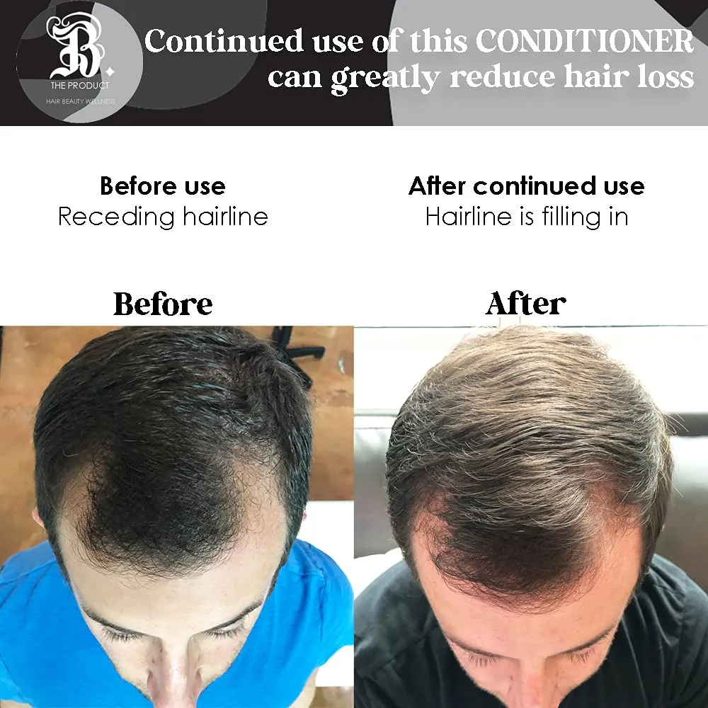 Biotin Vitamin Hair Growth Conditioner-(High Potency) Biotin Conditioner For Fastest Hair Growth, Anti Hair Loss Conditioner, Vitamins E, A, And C, B. THE PRODUCT