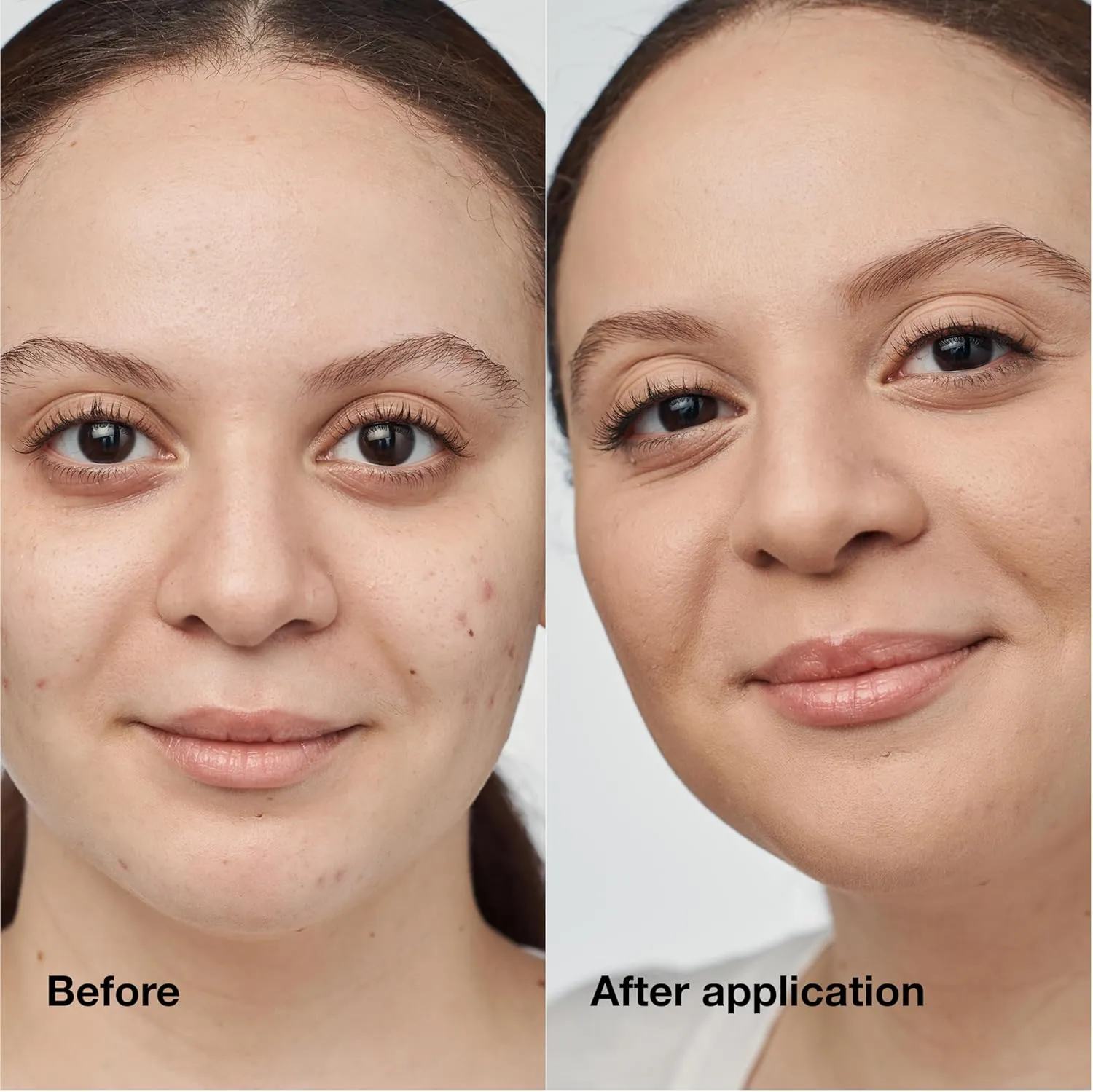 Clinique Even Better Clinical Serum Full Coverage Hydrating Foundation Broad Spectrum SPF 25 With Vitamin C, Salicylic Acid   Hyaluronic Acid For Oily Skin Types