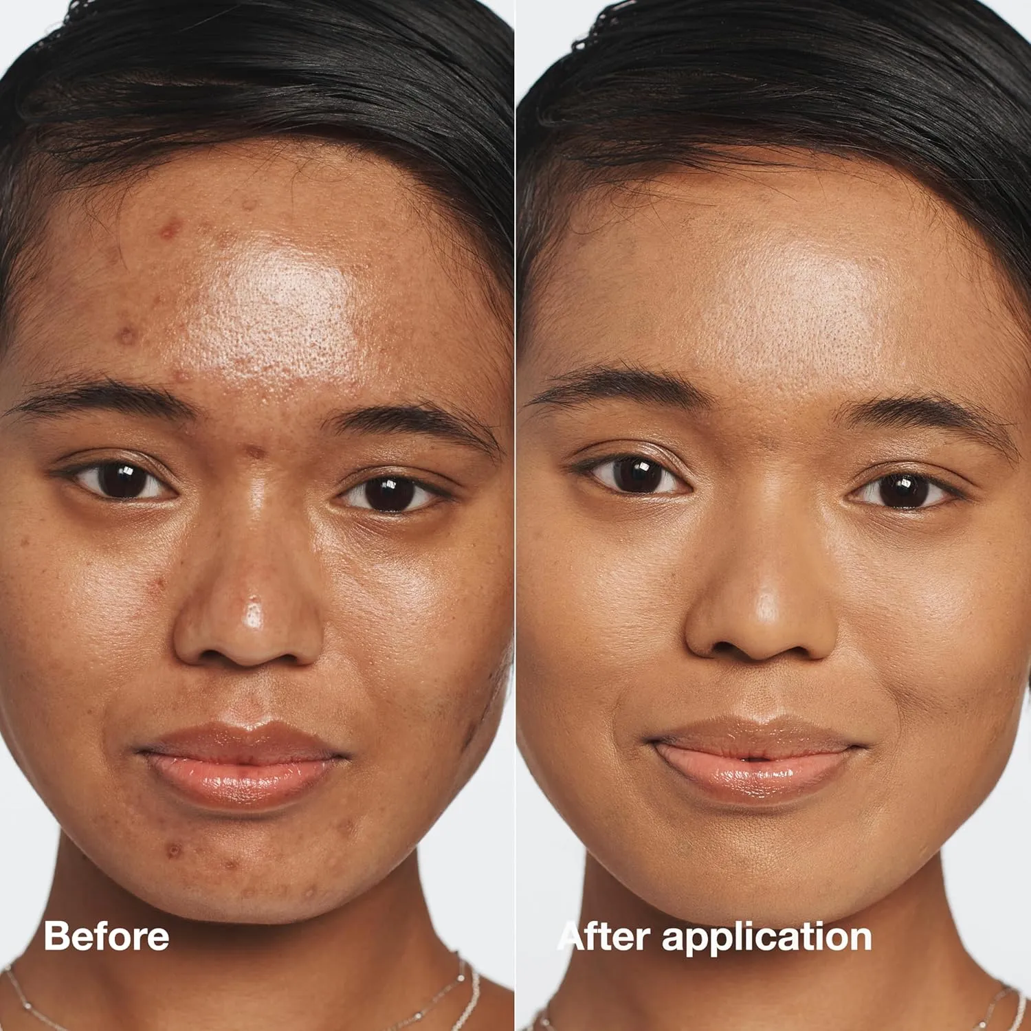Clinique Even Better Makeup Medium Coverage Foundation Broad Spectrum SPF 15 | Evens Skin Tone   Reduces Dark Spots