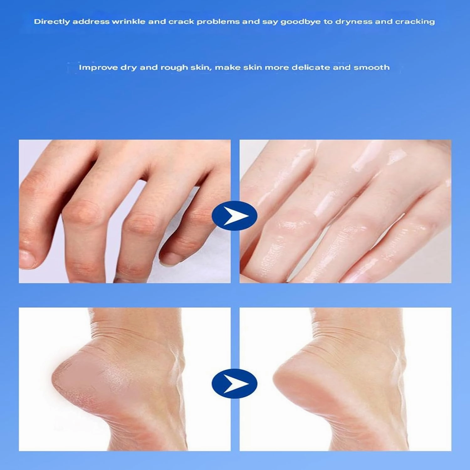 Equrhsa Foot Care Cream Cracked Feet,Eourhsa Crack Feet Prevention Stick,Cracked Heel Stick Balm,Heel Balm For Dry Crack FeetS,Anticrack Foot Cream Roll On,Hydrating And Anti-Cracking,Smoothing (B, 2)