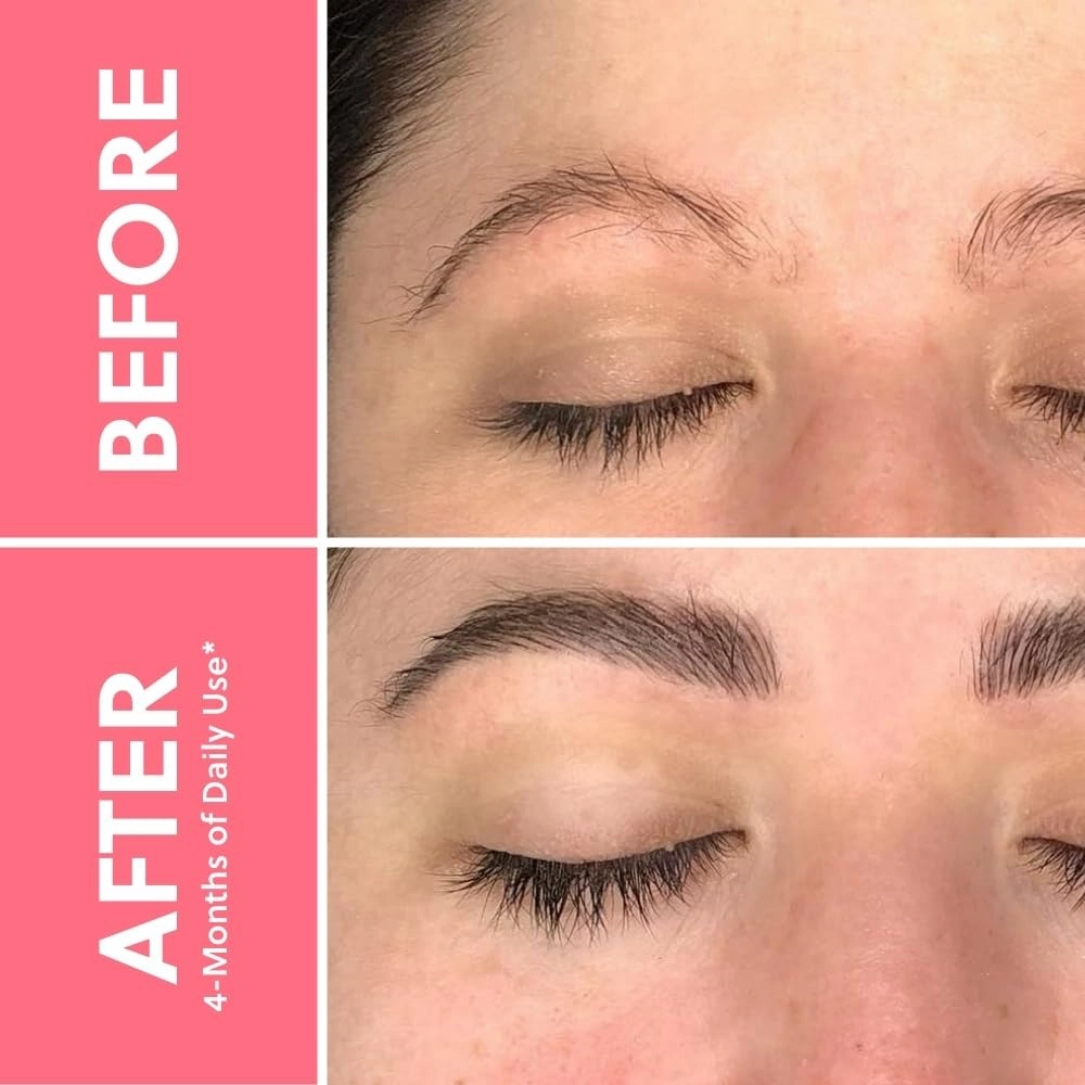 ForBrow by ForChics: 3 Pack Eyebrow Enhancing Serum - Thicker, Fuller Brows with Natural & Organic Conditioner | Vegan & Cruelty-Free with Innovative Peptides