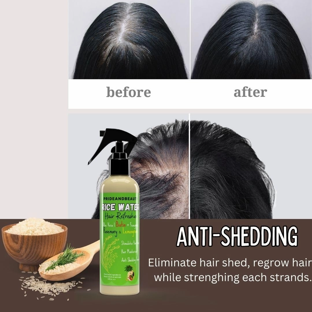 NEW Fermented Rice Water for Hair Growth - Infused with Rosemary, Biotin, Caffeine, Keratin Vegan Non-Greasy Spray Naturally Thicker, Longer, Softer Men & Women (8 OUNCES, Rosemary Lemongrass)