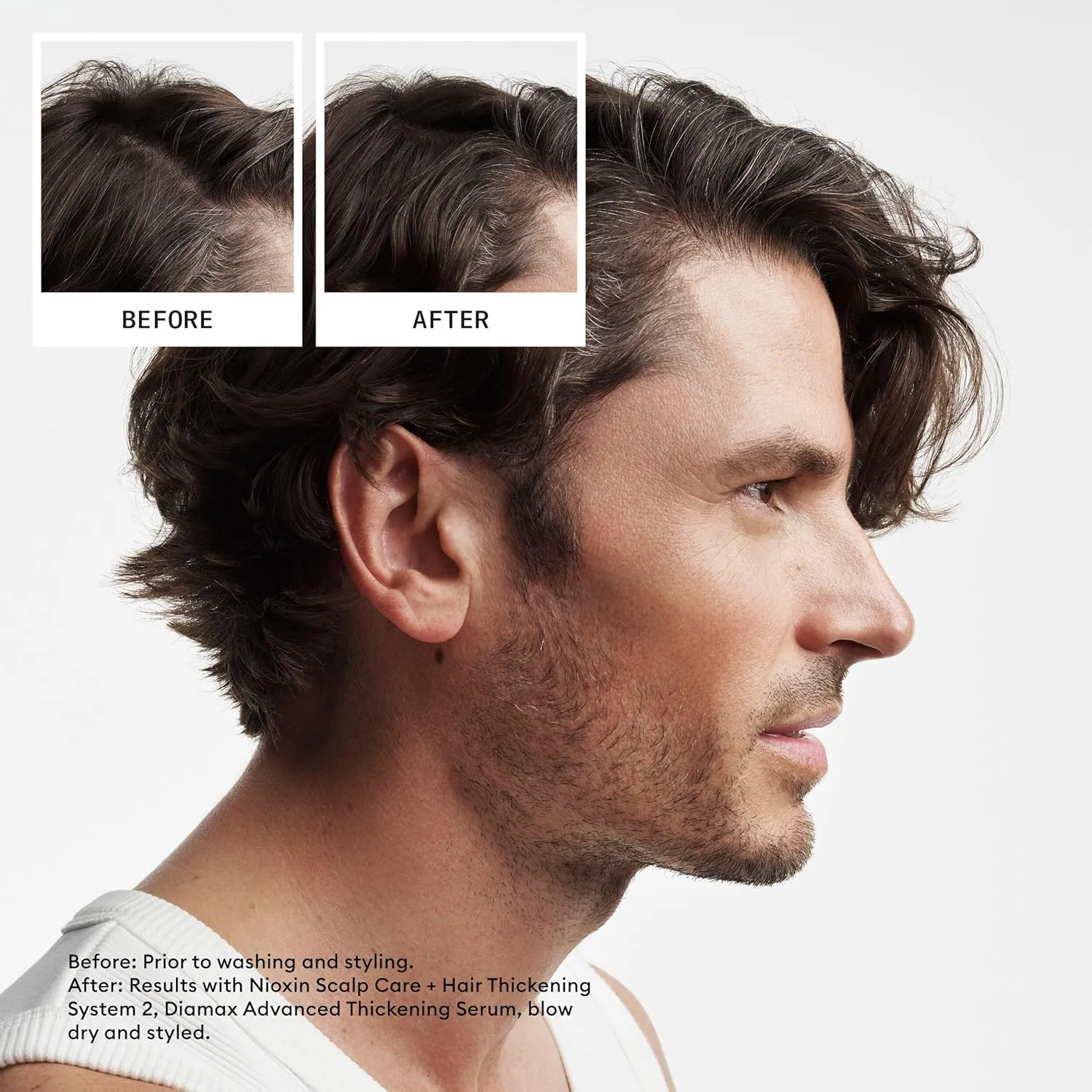 Nioxin System 2 Scalp   Hair Thickening Conditioner for Natural Hair with Progressed Thinning | Boost Hair Density with Niacinamide & Biotin | Refreshed Scalp with Healthy Shine
