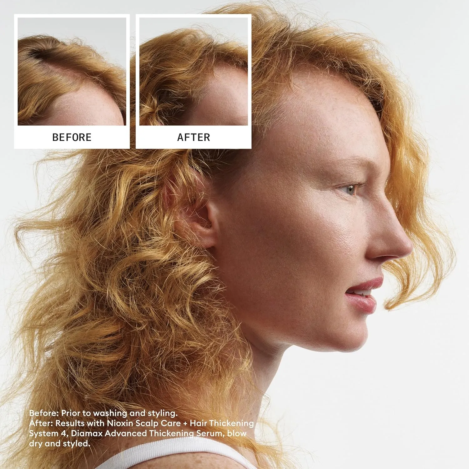 Nioxin System 4 Scalp   Hair Thickening Conditioner For Colored, Dry, & Damaged Hair with Progressed Thinning Maintain Vibrant Color Nourish & Boost Hair Density with Niacinamide & Biotin