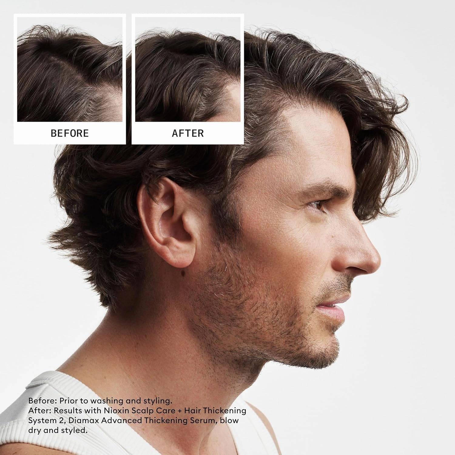 Nioxin System 2 Scalp   Hair Thickening Conditioner for Natural Hair with Progressed Thinning | Boost Hair Density with Niacinamide & Biotin | Refreshed Scalp with Healthy Shine
