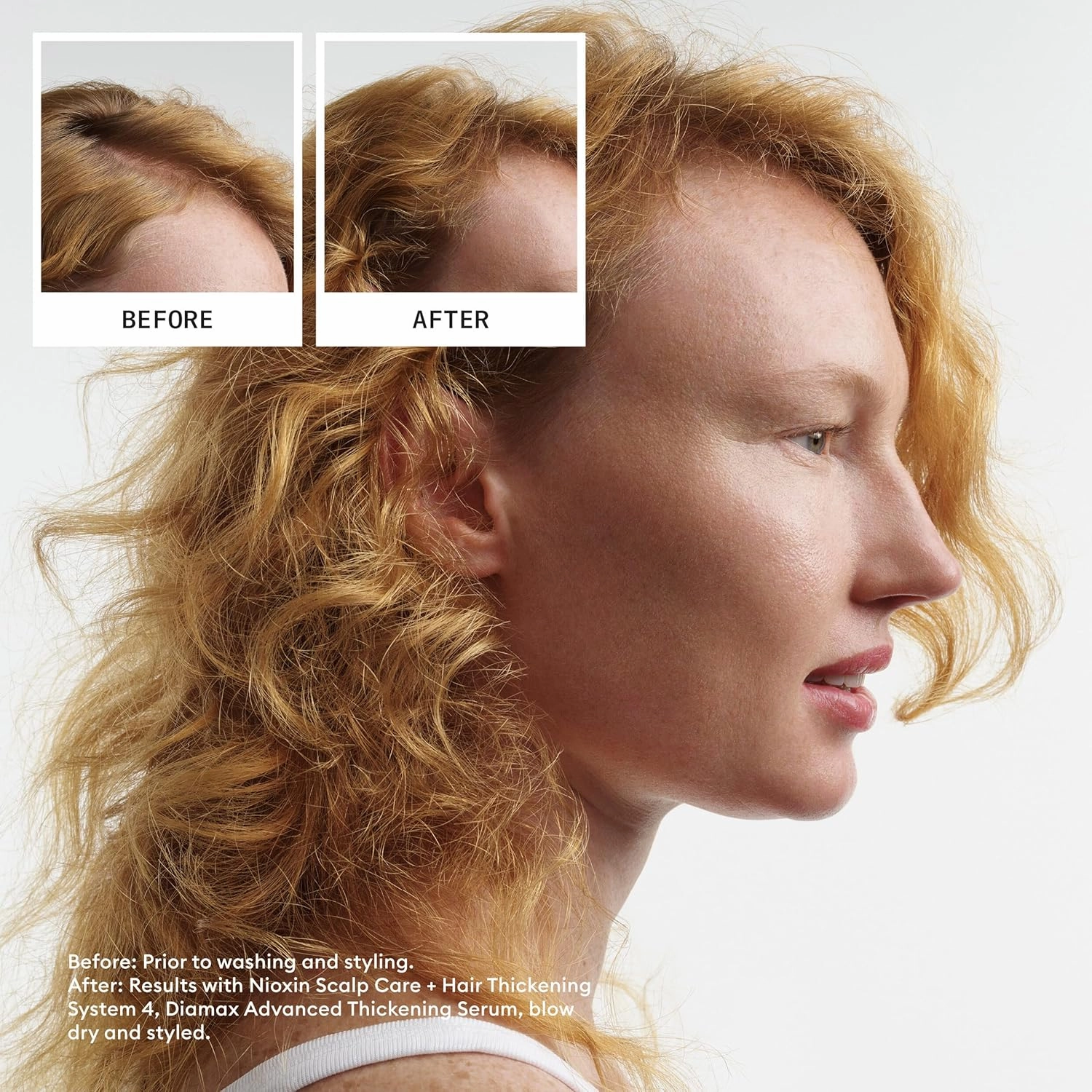 Nioxin System 4 Scalp   Hair Thickening Conditioner For Colored, Dry, & Damaged Hair with Progressed Thinning Maintain Vibrant Color Nourish & Boost Hair Density with Niacinamide & Biotin