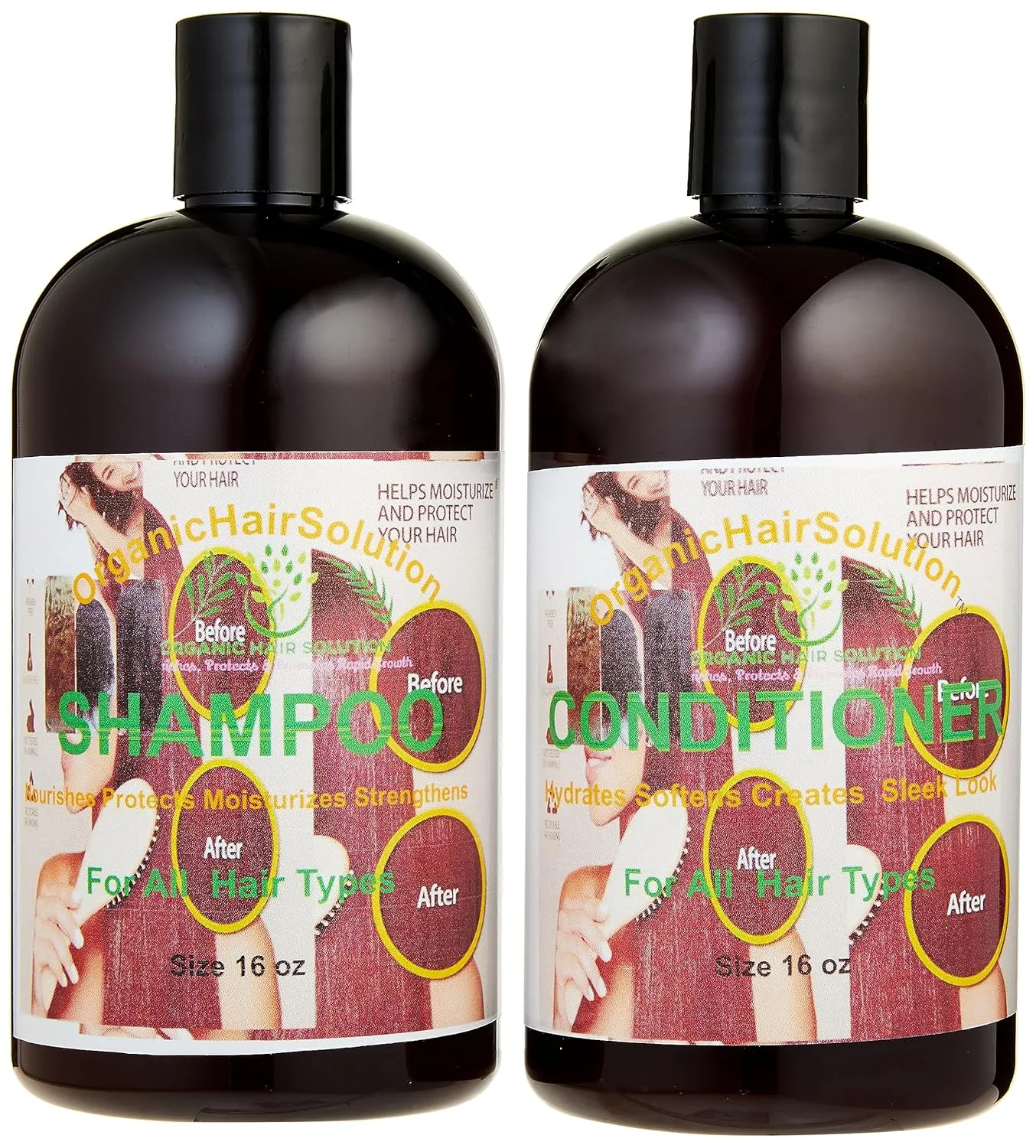 Organic Hair Solution- Conditioner & Shampoo Set -with 100% Pure Aloe vera &Tea Tree-for Itchy and Dry Scalp, Sulfate/Paraben Free -Promotes Hair Growth, Fights Hair Loss & Dandruff for Men & Women