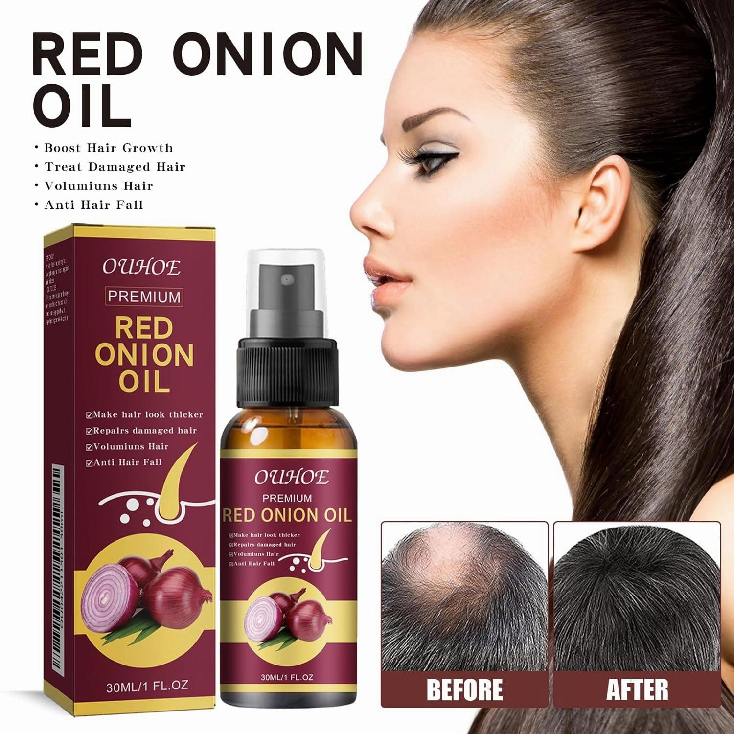 Red Onion Hair Oil for Hair Regrowth, Ouhoe Onion Oil for Hair Growth Anti Hair Fall for Shine & Strength, Red Onions Spray for Healthier Hair, Natural Herbs, Extracts & Oils (1pc)