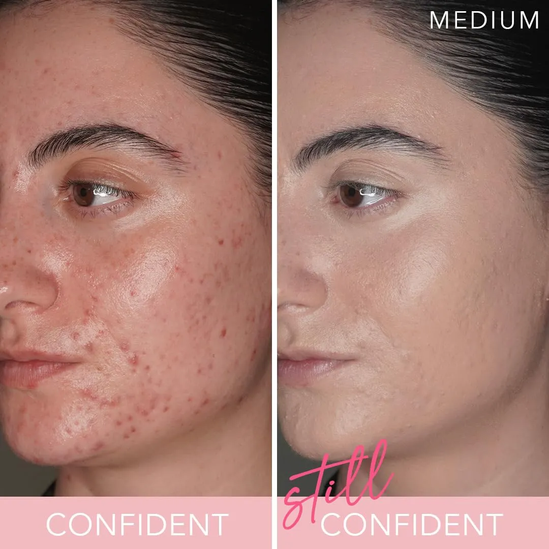 T.C.E This Covers Everything Super Coverage Serum Makeup with Peptides (Light/Medium, One Size)